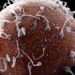 3 Faktor Penyebab Jumlah Sperma Sedikit