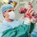 Operasi Caesar atau Persalinan Normal, Pilih Mana?