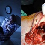 AWAS!!! Yang Suka Tidur Terlalu Malam Dan Bangun Terlalu Siang, Rentan Terserang KANKER HATI. Begini Cara Menghindarinya!