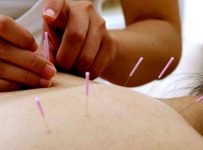 Terapi akupuntur mengobati disfungsi ereksi