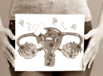 Cara mendeteksi kanker ovarium wanita